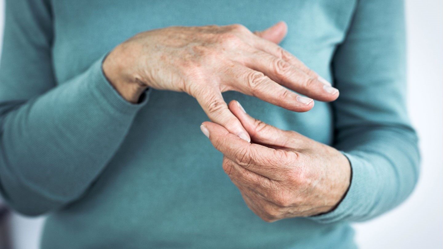 Hand calcification causing severe pain is more common in women
